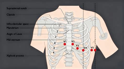 12 Lead Ecg Position