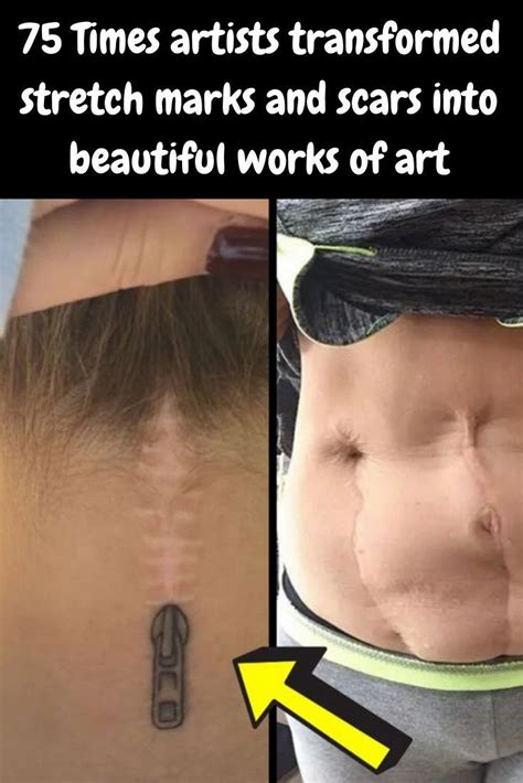 75 Times Artists Transformed Stretch Marks And Scars Into Beautiful