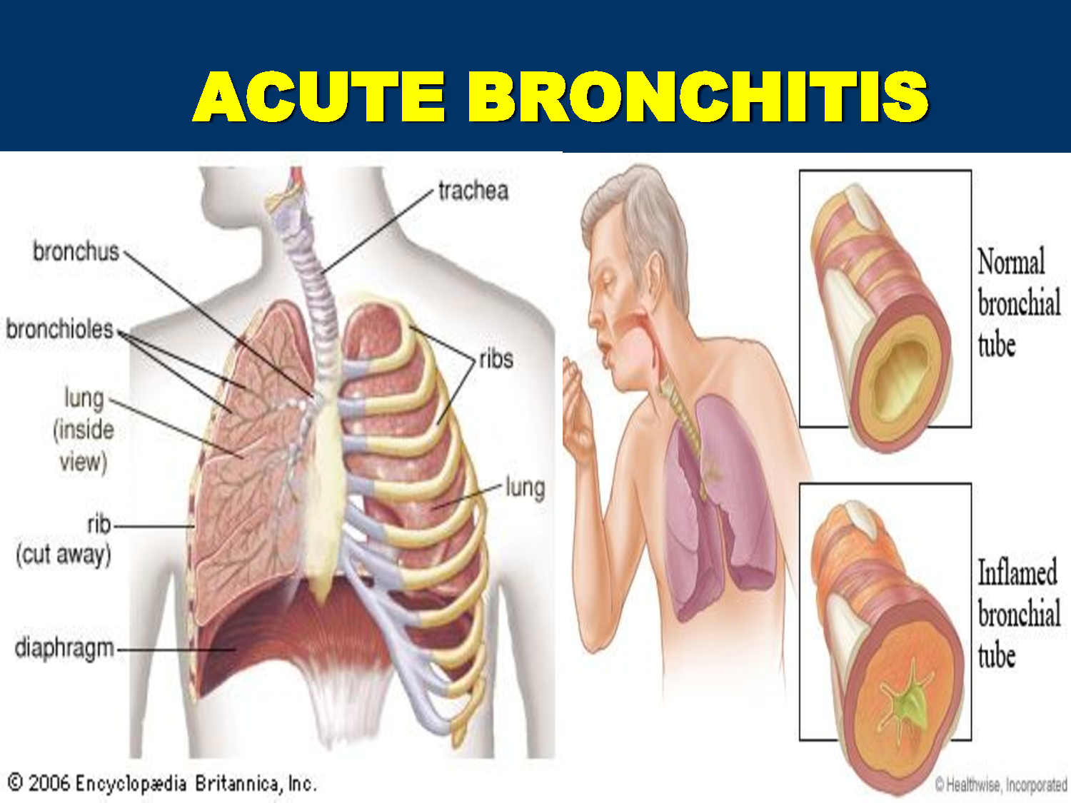 Acute Osseous Abnormality
