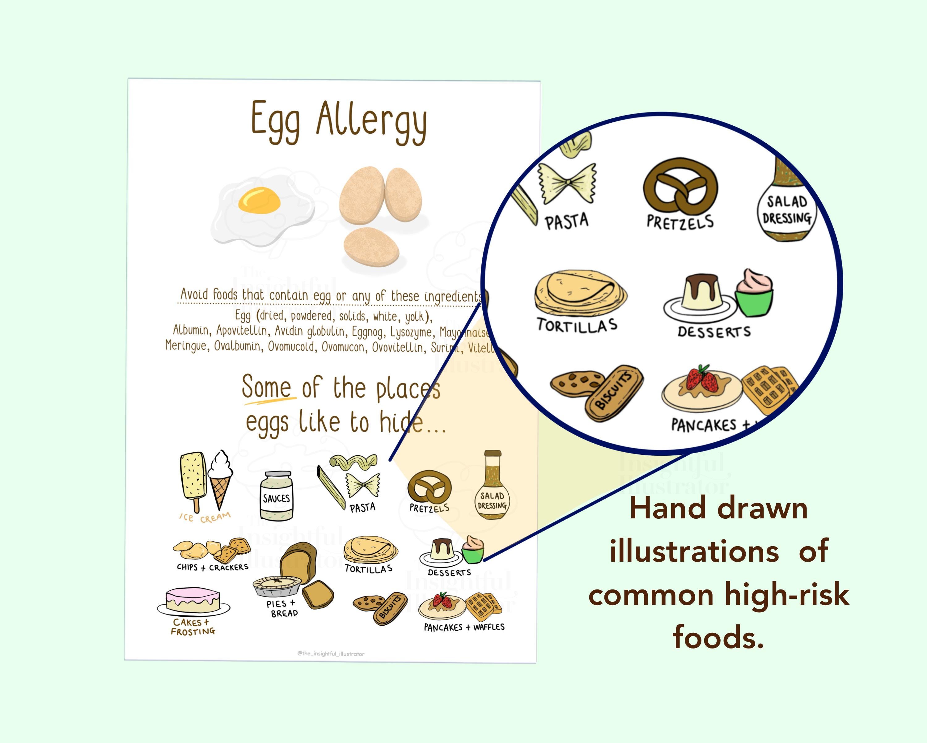Allergy Swollen Eyeball