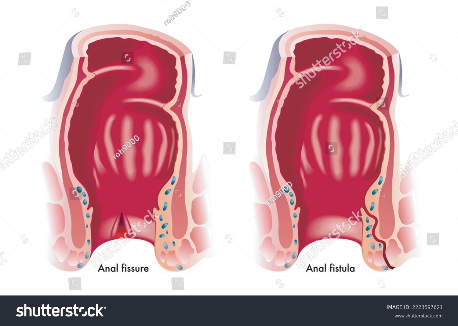 Anal High Definition