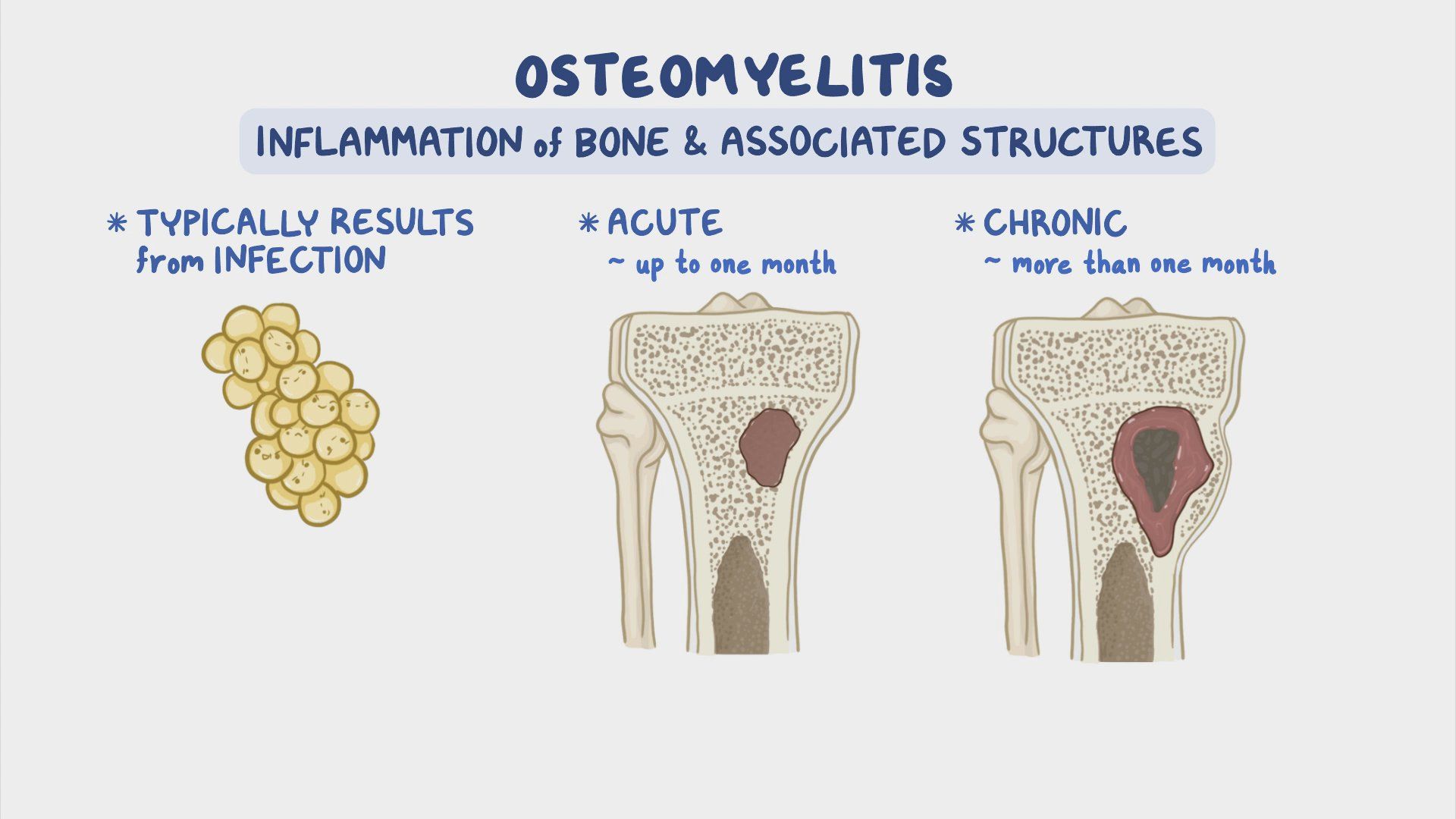 Apical Pulse Location