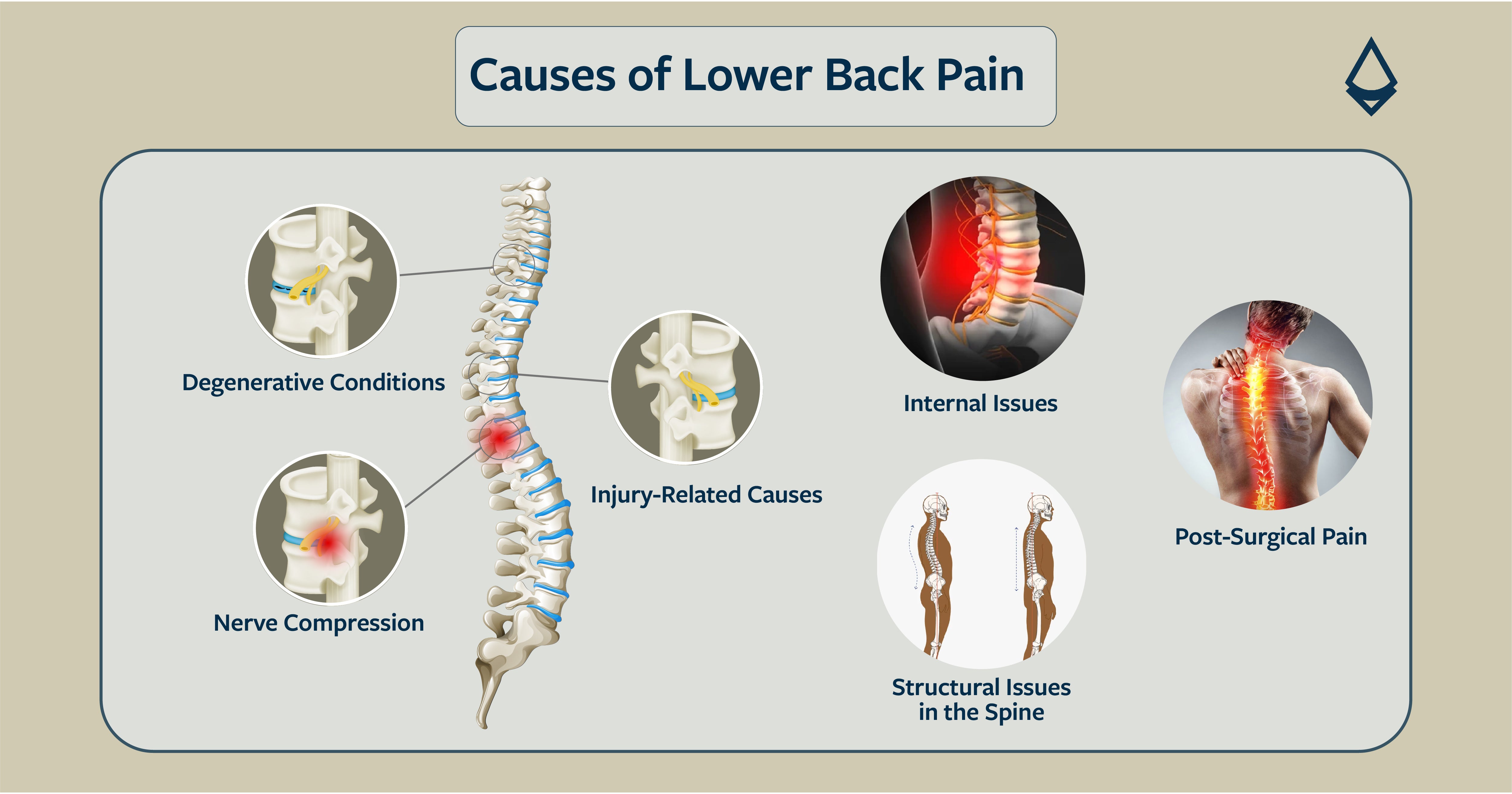 Back Decompression Machine