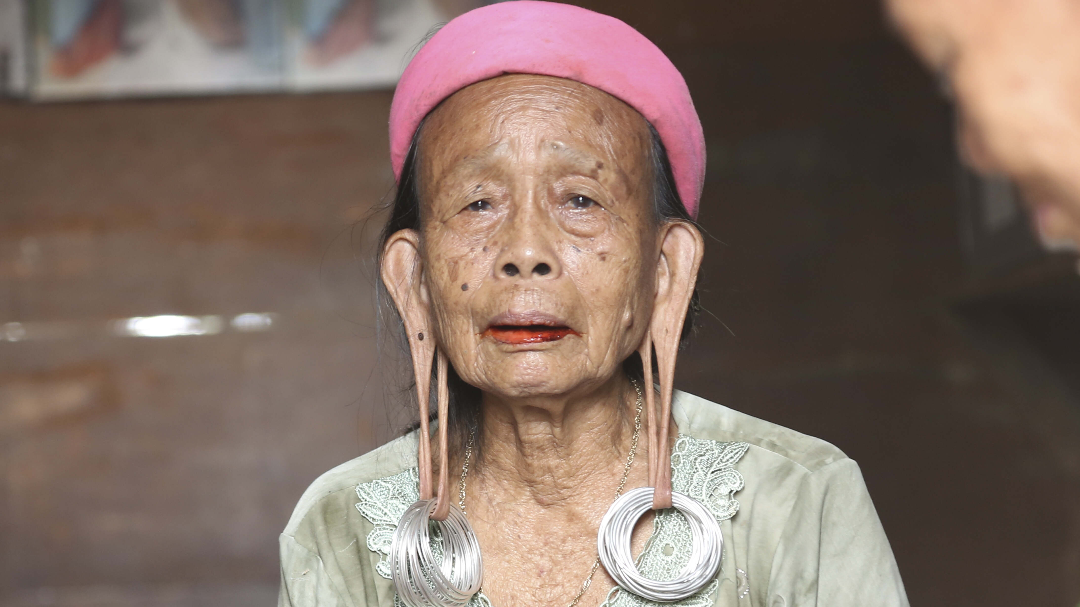 Meet The Man With The Biggest Ears In The World Human Record