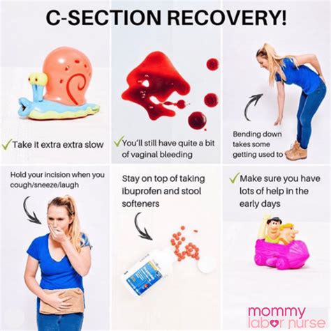 C Section Recovery