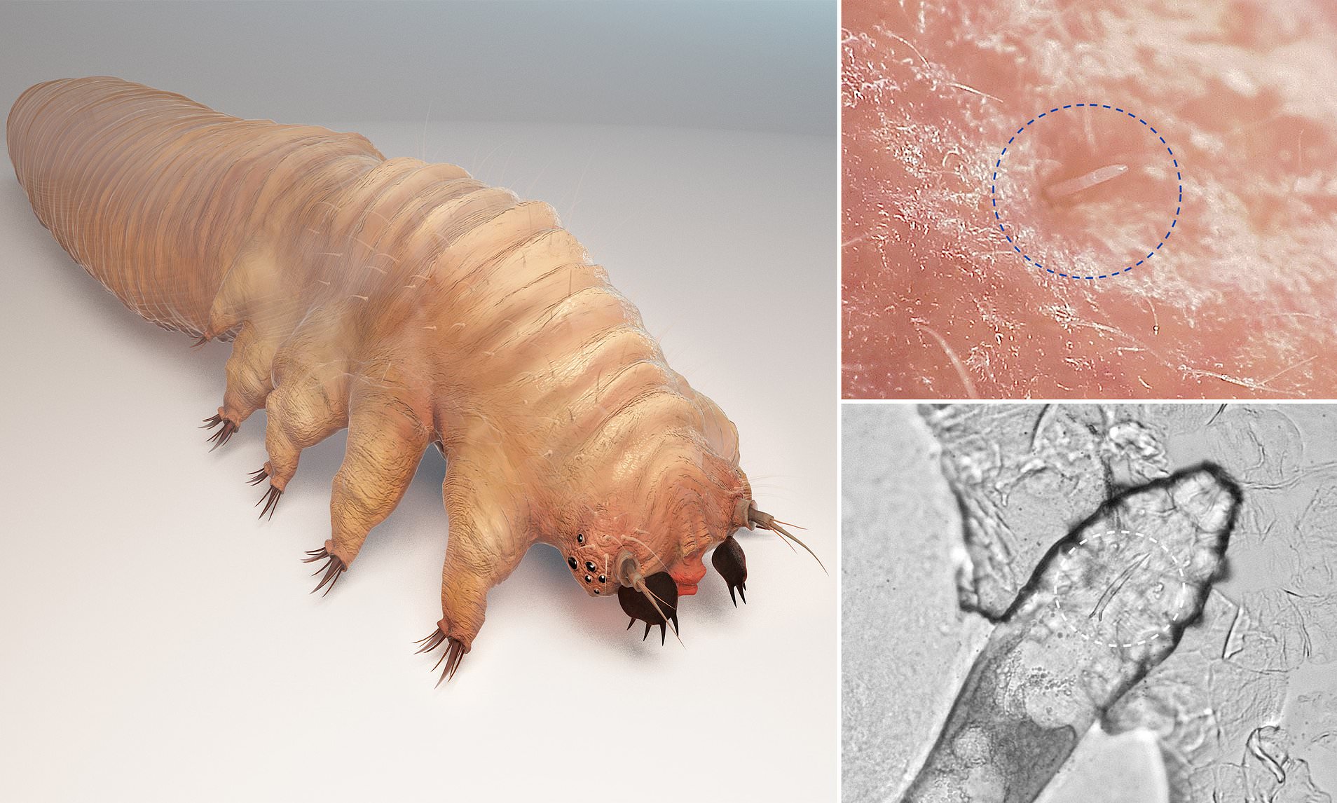 Can Bugs Actually Get Inside Your Body?