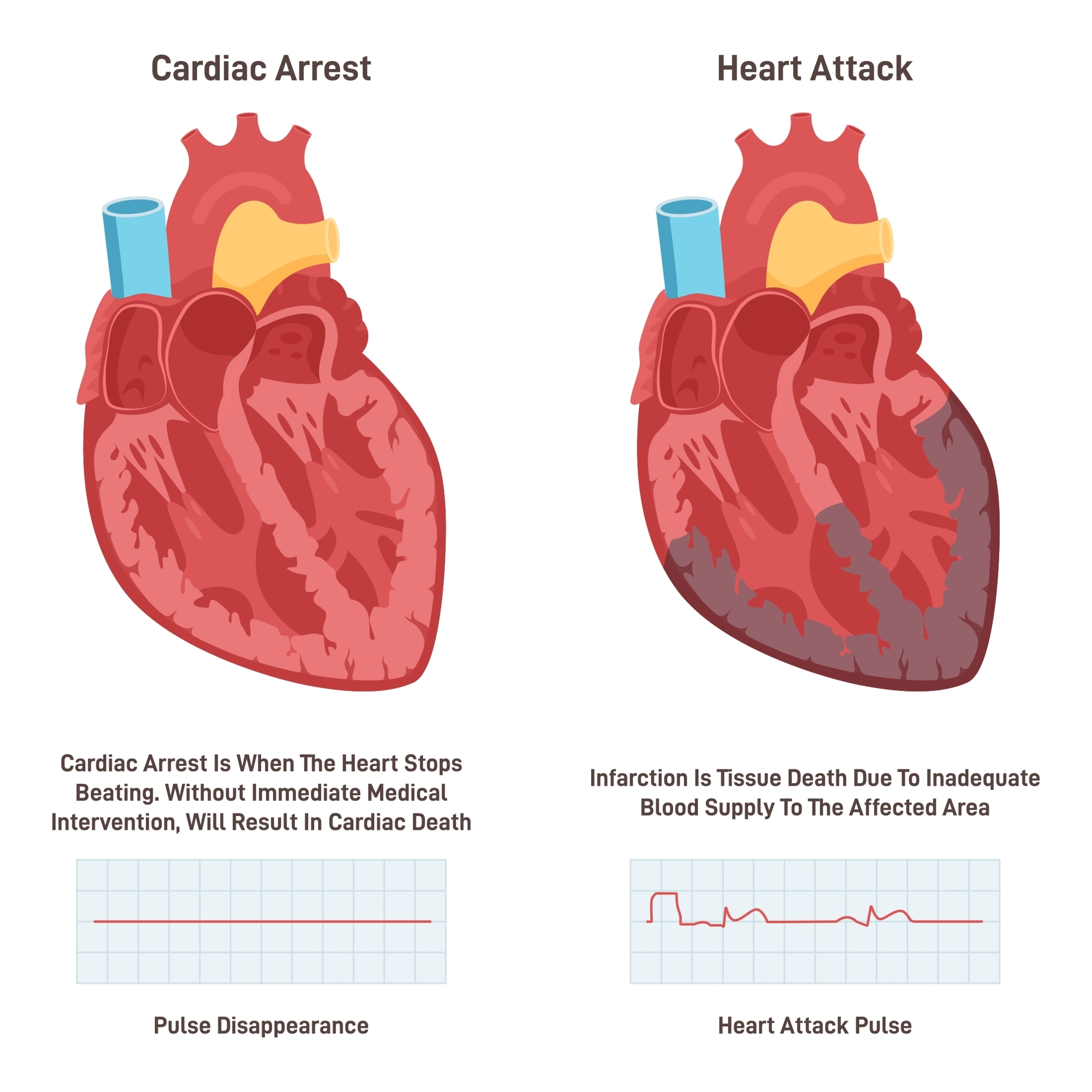 Can Insects Have Heart Attacks Doflies Survive Cardiac Arrest A Insects Heart Type User Guide