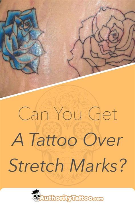 Can You Get A Tattoo Over Stretch Marks Authoritytattoo