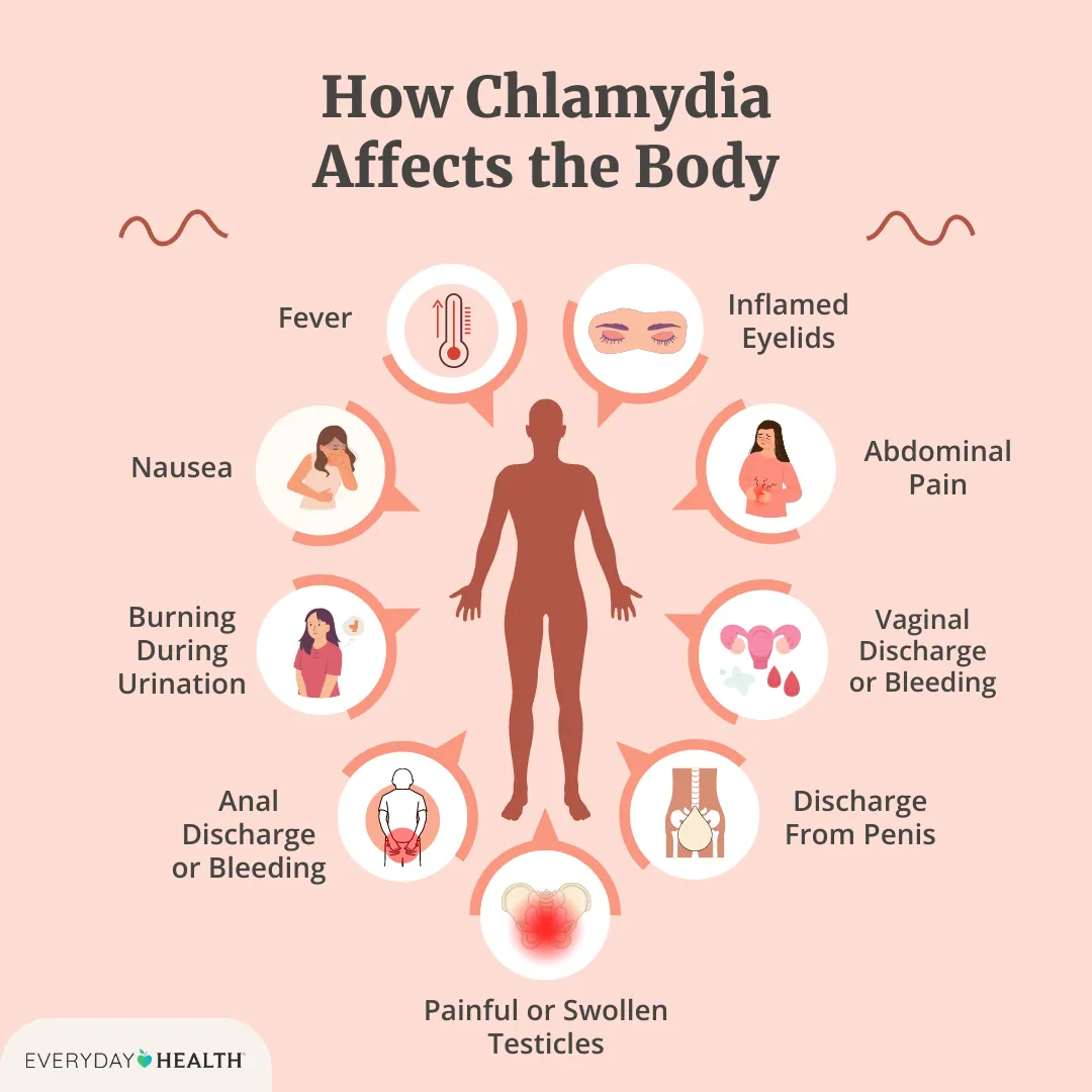 Chlamydia In Spanish