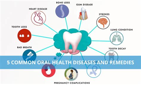 Ultimate Complete Guide to Oral Health Secrets Revealed