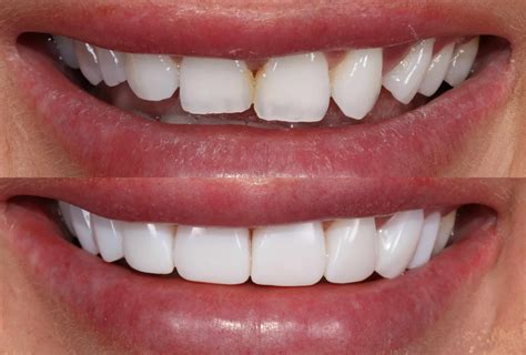Discover Cutting-Edge Cosmetic Dentistry Advanced Treatment Options Today