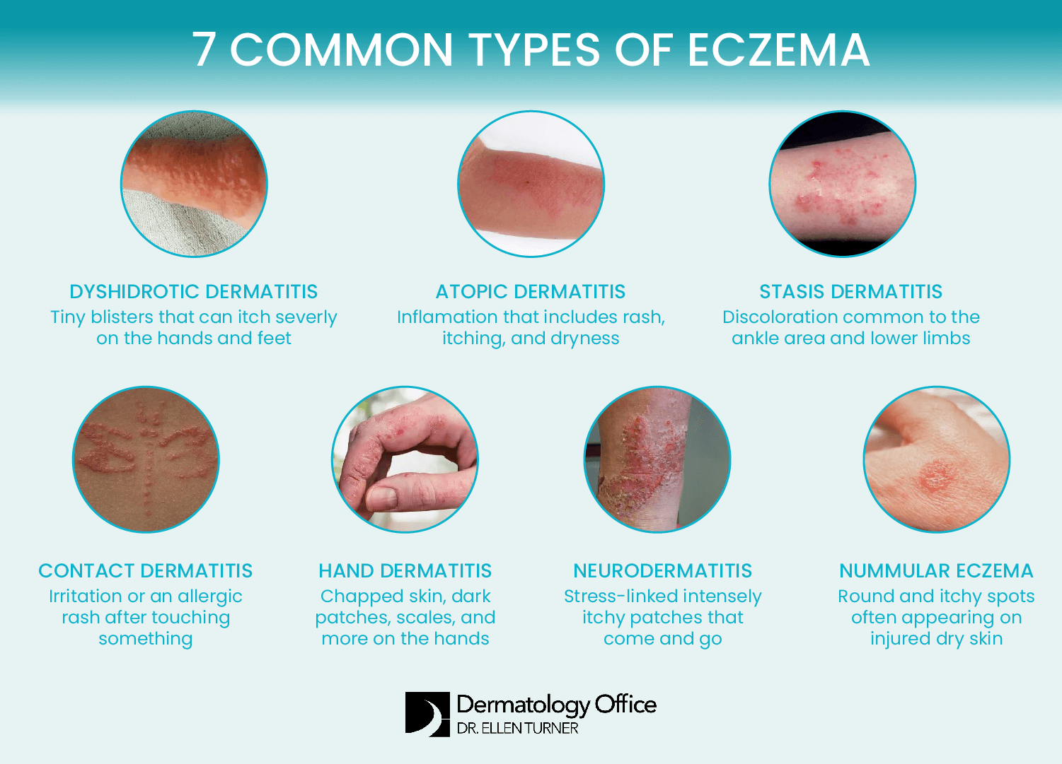 The Real Cure For Eczema: A Dermatologist Explains