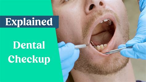 Unlock the Secrets of Your Dental Health with a Comprehensive Dental Checkup Explained