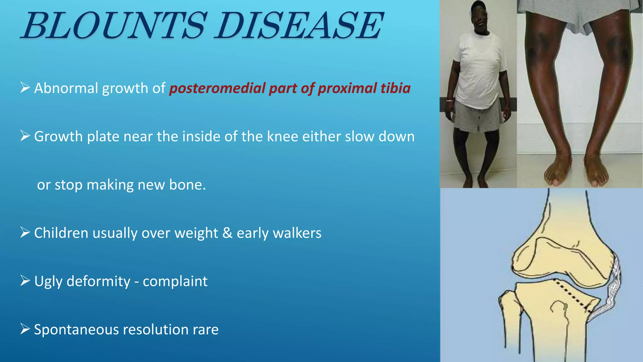 Disease Vs Illness