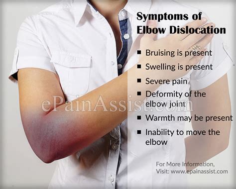 Dislocated Elbow Recovery Time