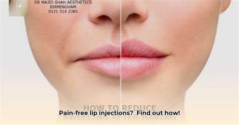 Do Lip Injections Hurt
