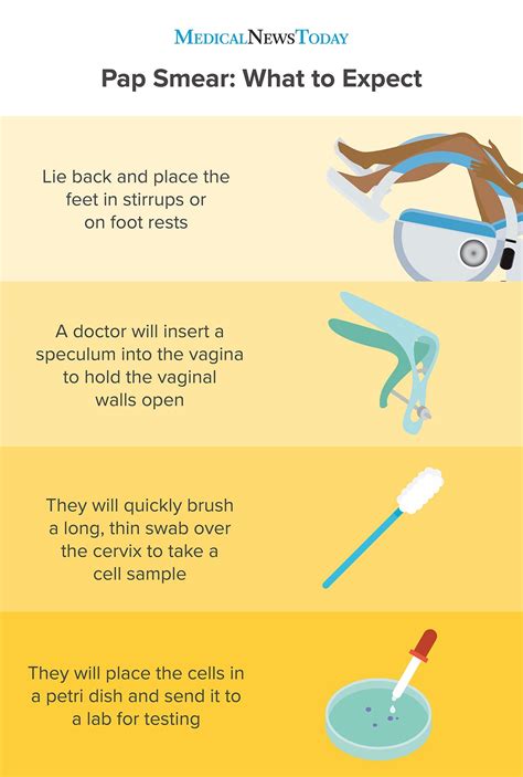 Do Pap Smears Hurt