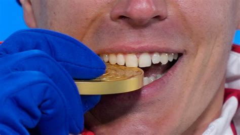 Do People Bite Gold