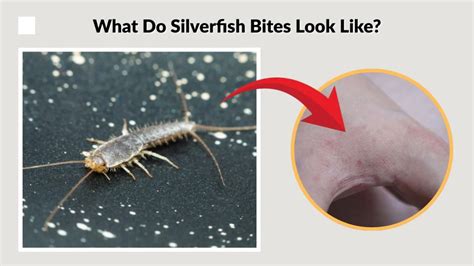Do They Bite Silverfish