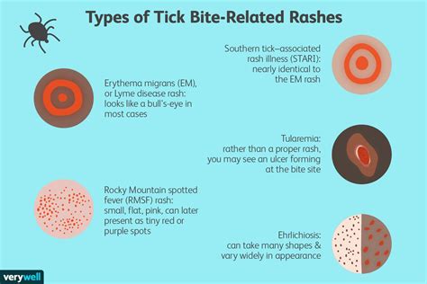 Do Ticks Die After They Bite