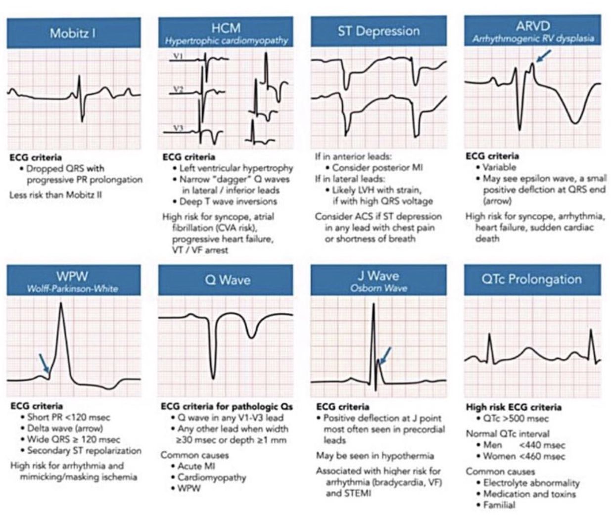 Ecg Leads Placement