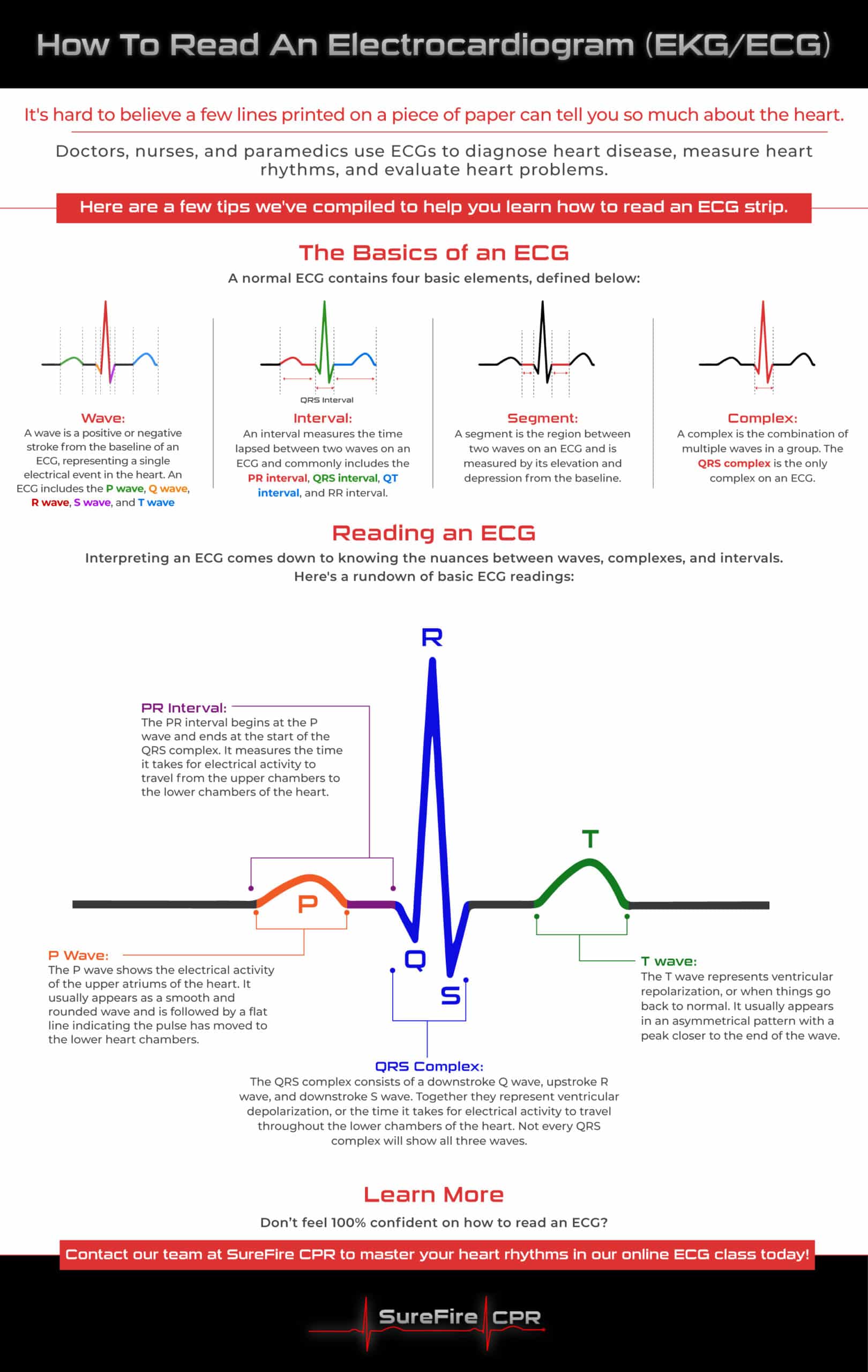 Ekg Lead Placements