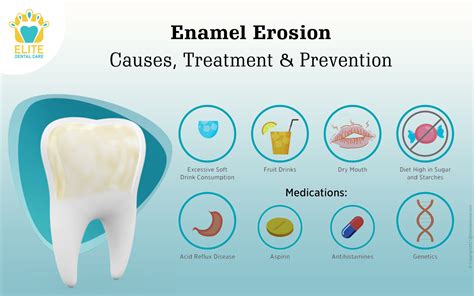 Enamel Care Dentist Advice for Healthy Teeth Success