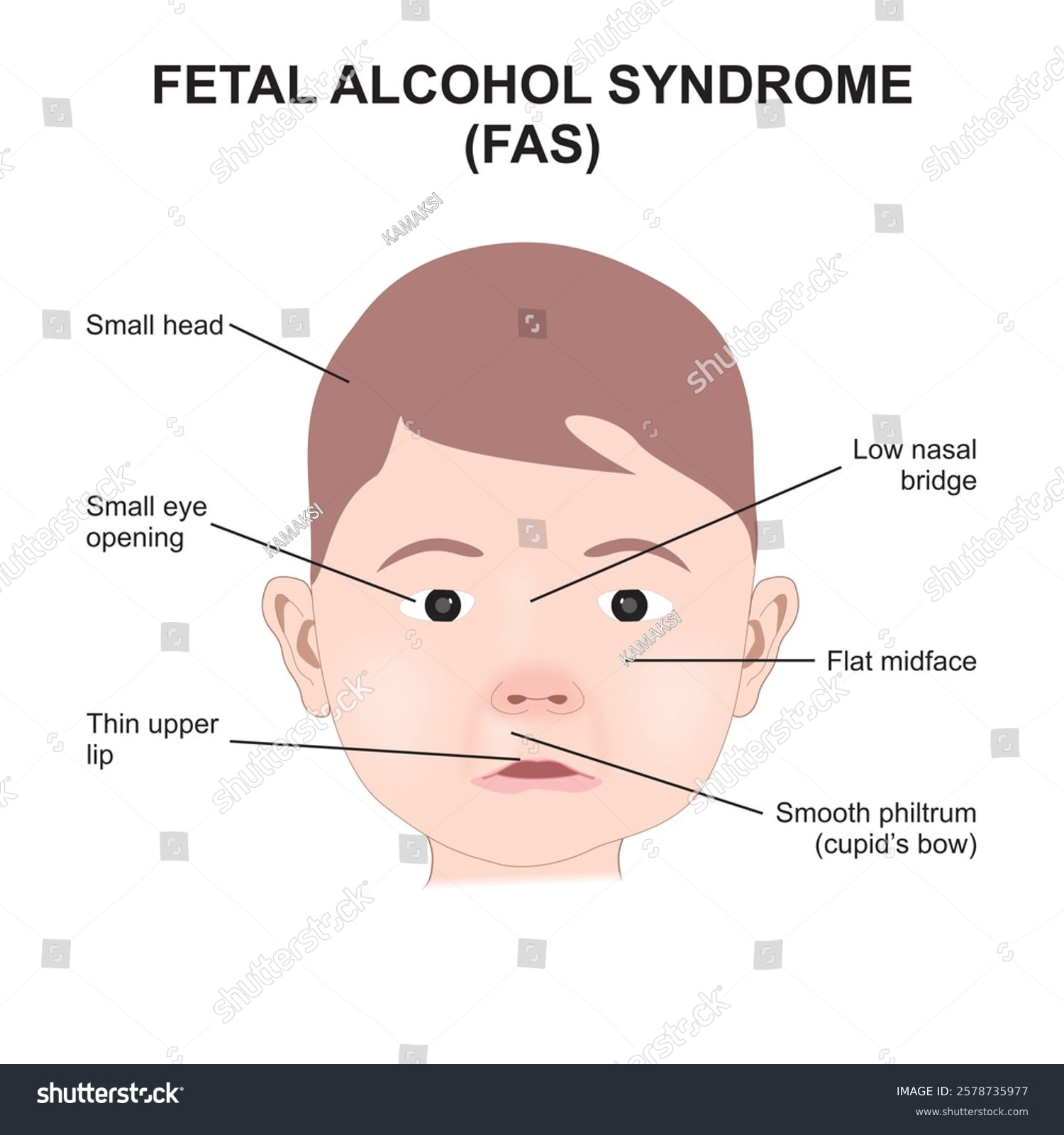Fetal Heart Tracing