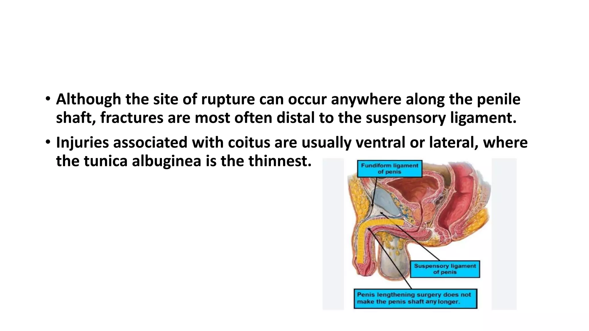 Fracture Broken Bone Difference