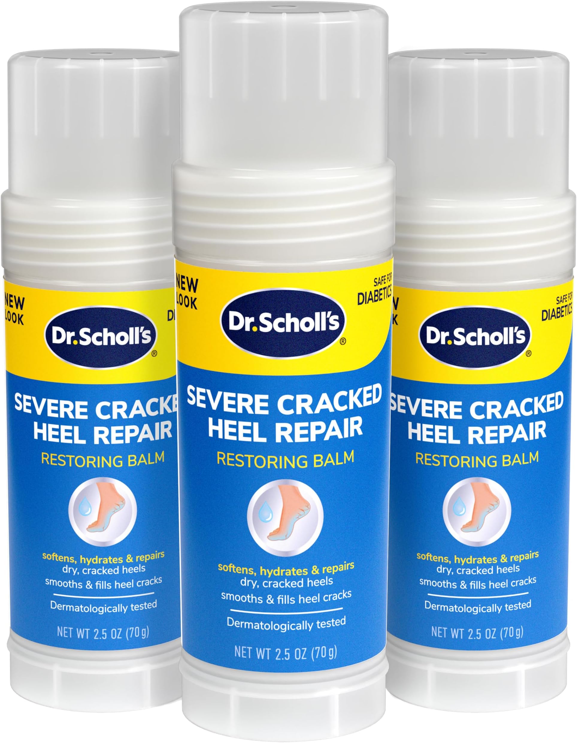 Heel Pain After Jogging