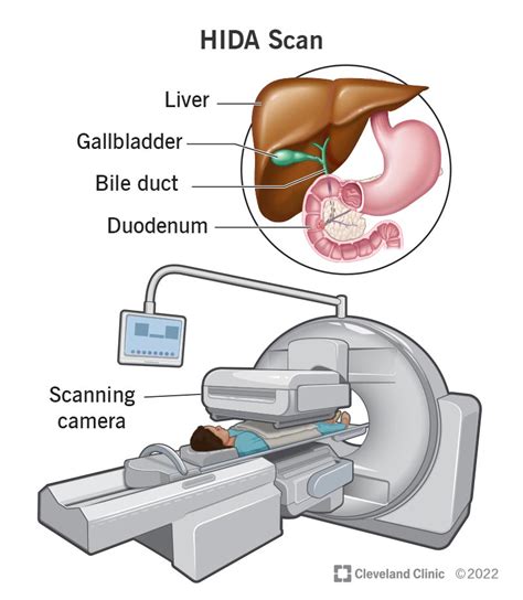 Hida Scan Procedure