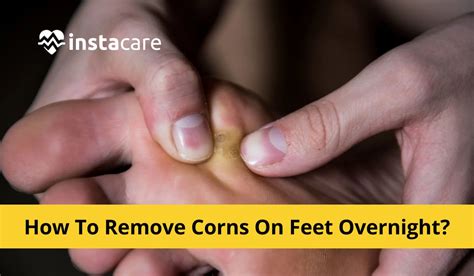 How Can I Remove Corns