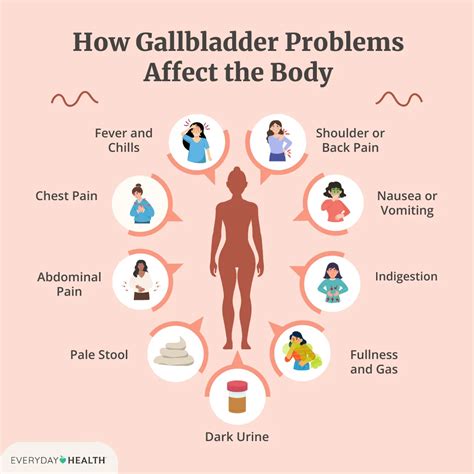 How Common Is Gallbladder Issues In Kids