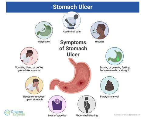 How Dangerous Is Ulcer