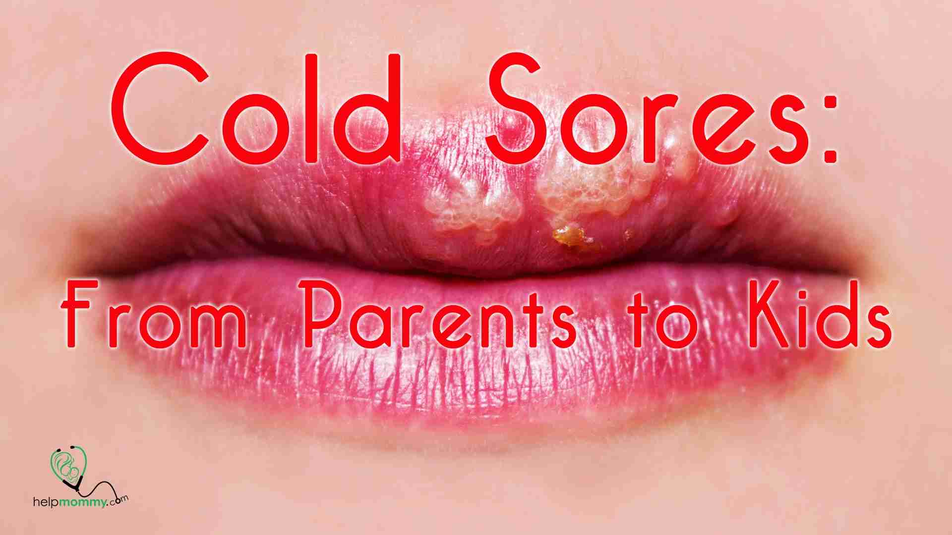 How Do Children Get Cold Sores: A Parents Guide To Causes And Triggers