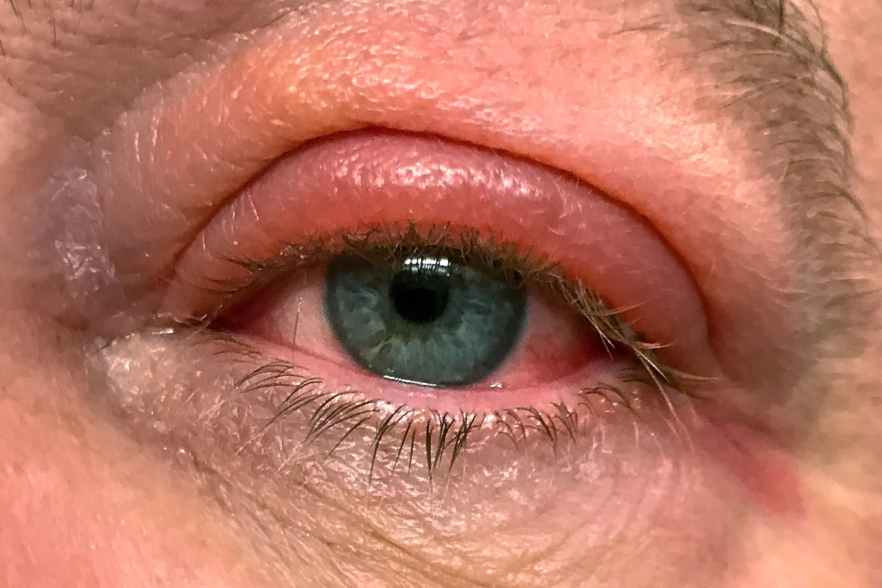 What Causes Eyes To Sparkle And How To Get Them Like Celebrities
