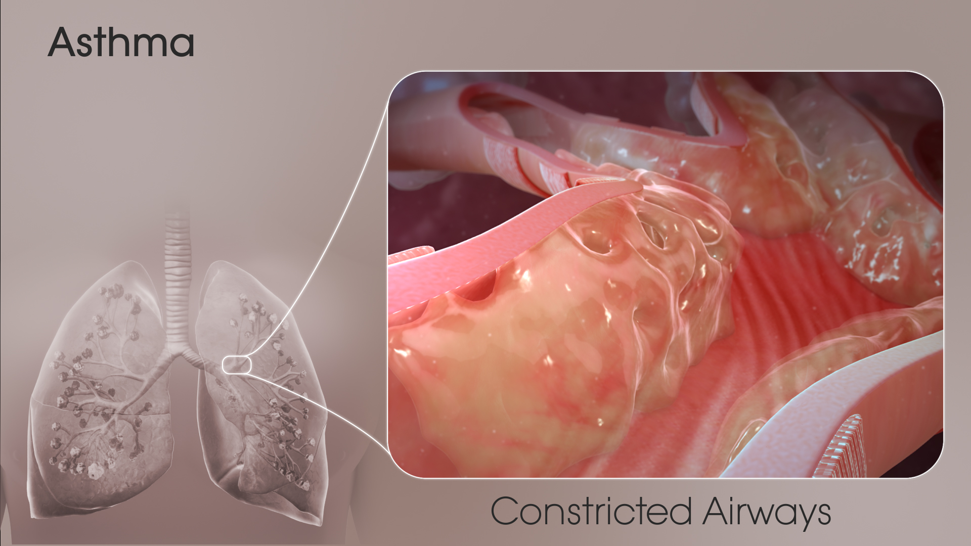 How Do Lungs Look With Mucus Buildup Inside Them?