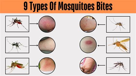 How Do You Bite Mosquitoes
