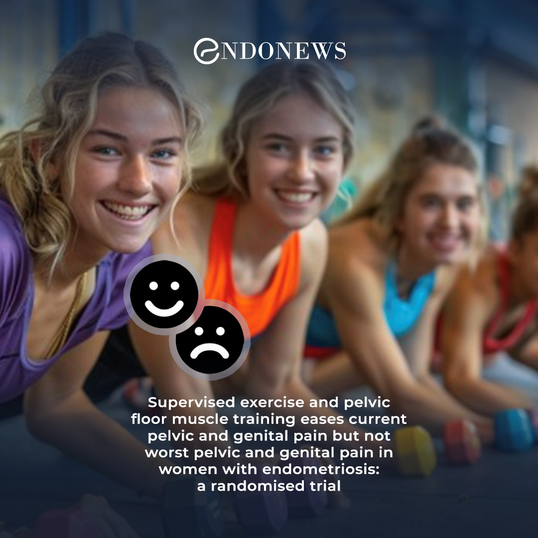 How Exercise Helps Endometriosis Symptoms