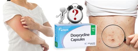 How Fast Does Doxycycline Work