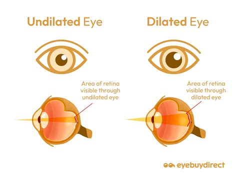 How Long Does Dilation Last Eye