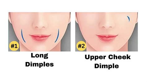 How Rare Is Having One Dimple