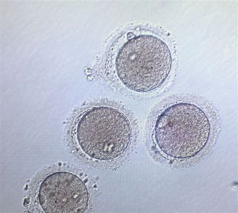How Small Is Female Egg