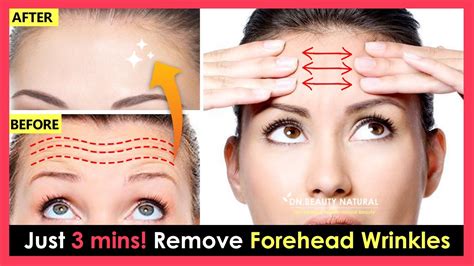 How To Avoid Forehead Wrinkles