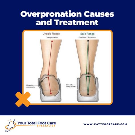 How To Correct Overpronation