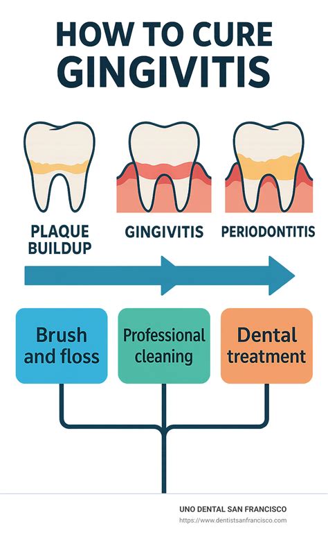 How To Cure Gingivitis