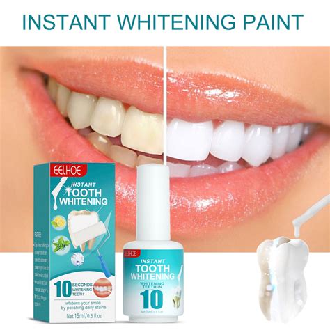 Natural Ways to Prevent Teeth Whitening