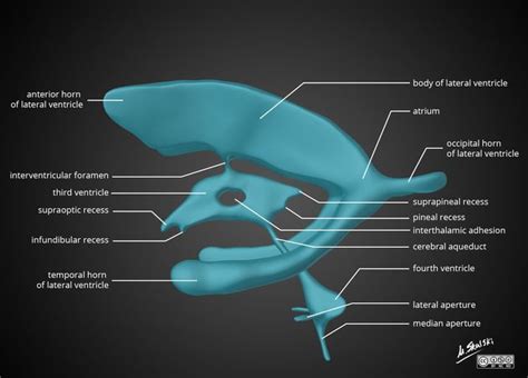 Interventricular Foramen Monro