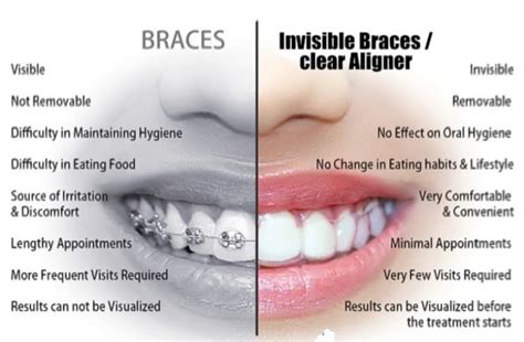 Invisible Braces Cost in Canada: What to Expect?