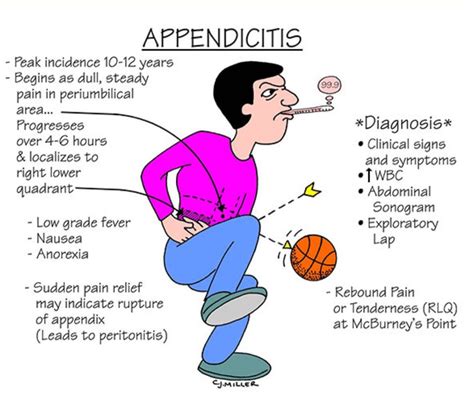 Is Appendicitis Genetic